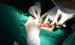 Phẫu thuật thẩm mỹ sẹo, tạo hình vành tai sau tổn thương do khối u lớn