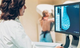 C&#225;c x&#233;t nghiệm cần l&#224;m khi c&#243; dấu hiệu nghi ngờ mắc ung thư v&#250;