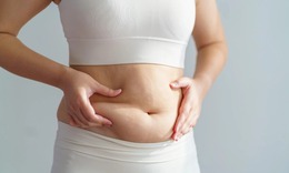 Mỡ n&#226;u v&#224; mỡ trắng, n&#234;n ‘k&#237;ch hoạt’ m&#244; mỡ n&#224;o để kiểm so&#225;t c&#226;n nặng?
