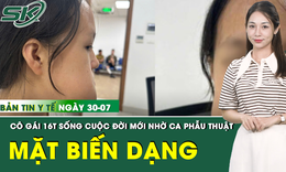 Bản Tin Y Tế 30/7: Tái tạo gương mặt biến dạng cho cô gái 16 tuổi do khối u lớn