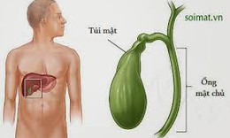 Ung thư túi mật có chữa khỏi không?