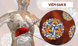 Biểu hiện của vi&#234;m gan B giai đoạn đầu