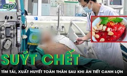 Nam thanh niên 30 tuổi suýt chết sau khi ăn tiết canh lợn