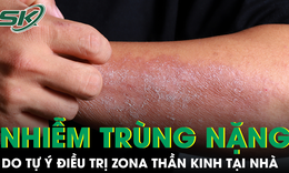 Tự chữa zona thần kinh, người đàn ông nhập viện vì nhiễm trùng nặng, vết thương chảy mủ