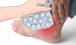 Cách giảm đau nhanh cơn gout cấp