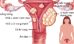 Chuyển đổi số ng&#224;nh y tế: H&#224;nh tr&#236;nh &#39;ph&#242;ng bệnh hơn chữa bệnh&#39; của hai người phụ nữ Thủ đ&#244;