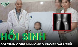 Hồi sinh đôi chân vòng kiềng hình chữ O cho bé gái 8 tuổi