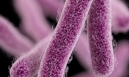 Pháp thu hồi phô mai mềm sau 2 ca tử vong nghi nhiễm khuẩn listeria