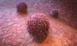 Công nghệ mới giúp đưa thuốc nhắm chính xác vào tế bào ung thư