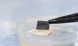 Miếng d&#225;n tại nh&#224; c&#243; thể gi&#250;p ph&#225;t hiện ung thư da