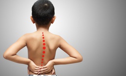 Vẹo cột sống phát hiện như thế nào?