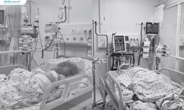 Hai chị em nguy kịch v&#236; cha đổ xăng ph&#243;ng hỏa