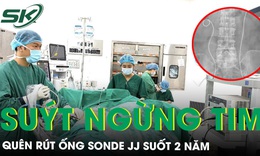 Quên rút ống sonde JJ sau phẫu thuật cắt bàng quang, bệnh nhân Hà Nội suýt ngừng tim