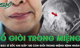 Bệnh nhân 69 tuổi nhập viện vì khó thở, bác sĩ sốc khi phát hiện hơn 100 con giòi trong miệng