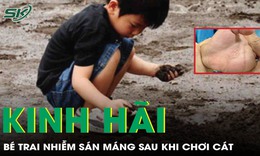 Kinh hãi phát hiện nguyên nhân những đường ngoằn ngoèo trên lòng bàn tay bé trai 4 tuổi