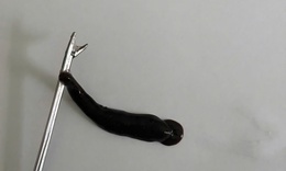 Đỉa d&#224;i 4cm k&#253; sinh trong mũi b&#233; trai suốt 10 ng&#224;y
