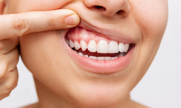 Ăn uống đồ qu&#225; n&#243;ng, qu&#225; lạnh: Kẻ th&#249; &#226;m thầm của răng v&#224; nướu (lợi)