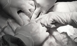 Dùng thuốc nam chữa u nang buồng trứng, người phụ nữ mang khối u nặng 9kg suốt 3 năm