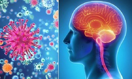 Bị bệnh truyền nhiễm cấp tính não mô cầu xâm lấn, nguy cơ tử vong cao