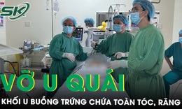Đau bụng dữ dội, kinh ho&#224;ng ph&#225;t hiện vỡ &#39;u qu&#225;i&#39; buồng trứng chứa to&#224;n t&#243;c, răng