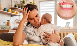 Phụ nữ sau sinh kh&#244;ng được đ&#225;nh răng: Hiểu lầm tai hại