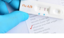 C&#250;m A, bệnh &#39;quen mặt&#39; nhưng kh&#244;ng hề l&#224;nh t&#237;nh