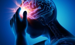 Dị dạng mạch m&#225;u n&#227;o c&#243; nguy hiểm kh&#244;ng?