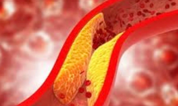 6 loại đồ uống khi bụng đ&#243;i gi&#250;p giảm cholesterol xấu