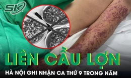 H&#224; Nội ghi nhận ca nhiễm li&#234;n cầu lợn thứ 9 trong năm 