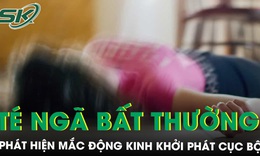 T&#233; ng&#227;, co giật, nam sinh 16 tuổi được ph&#225;t hiện mắc động kinh khởi ph&#225;t cục bộ 