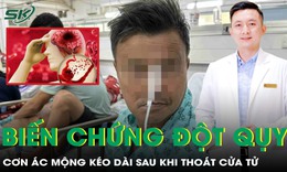 Biến chứng đột quỵ: &#39;Cơn &#225;c mộng&#39; k&#233;o d&#224;i sau khi tho&#225;t cửa tử