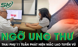 Thai phụ 11 tuần được chẩn đo&#225;n lao tuyến v&#250; sau nhiều th&#225;ng điều trị nhầm vi&#234;m v&#250;, &#225;p xe