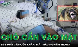 Chó cắn vào mặt, bé 5 tuổi phải cấp cứu khẩn vì mất máu nghiêm trọng