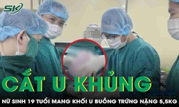 Cắt khối u buồng trứng nặng 5,5kg cho nữ sinh 19 tuổi