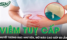 Lọc m&#225;u cứu người đ&#224;n &#244;ng c&#243; huyết tương đục như sữa, mỡ m&#225;u cao gấp 80 lần 