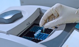 Đột biến CFAP65 khiến tinh trùng bất động 