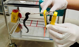 Đỉa dài 10 cm sống ký sinh trong mũi người bệnh