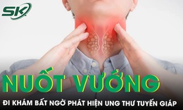 Nuốt vướng, mệt mỏi đi khám bất ngờ phát hiện ung thư tuyến giáp