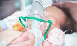 Trẻ ho, sốt, khó thở do viêm mủ màng phổi dễ nhầm với nhiễm khuẩn hô hấp