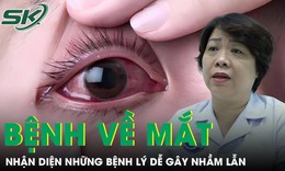 Nhận diện các bệnh lý mắt thường gặp dễ gây nhầm lẫn