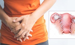 Đang viêm phần phụ có nên sinh hoạt tình dục?