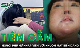 Người phụ nữ nhập viện với khuôn mặt biến dạng sau khi tiêm cằm