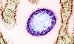 Những rào cản khiến virus Nipah chưa có vaccine