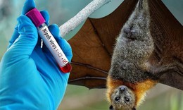 Virus Nipah gây bệnh gì, nguy hiểm như thế nào?