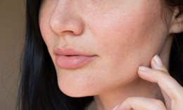 Ngứa ngáy da mặt, khó chịu, cảnh giác với nhiễm nấm