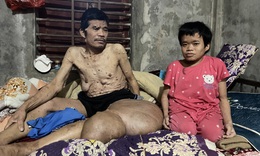 Người đàn ông có khối u khổng lồ đau xót nhìn vợ con lay lắt vì bệnh tật