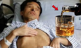 Người đàn ông 53 tuổi mắc ung thư gan, 'thủ phạm' là thói quen phổ biến
