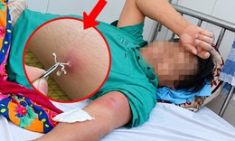 Uống nước suối khi đi rừng, người đàn ông bất ngờ mắc bệnh giun rồng nguy hiểm