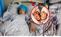Bé trai 8 tuổi suy thận nặng vì món ăn 'quốc dân' trẻ nào cũng thích
