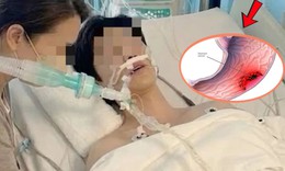 Nam sinh 17 tuổi mắc ung thư dạ dày giai đoạn cuối, bỏ qua dấu hiệu phát hiện bệnh này